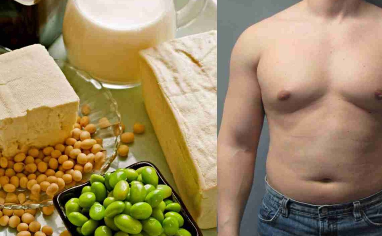 Gynecomastia: What It Is, Causes, Diagnosis & Treatment