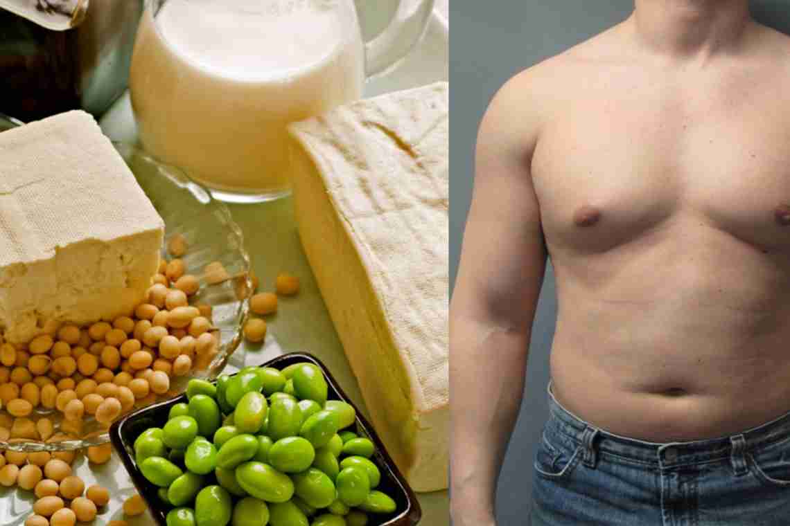 do i have gyno