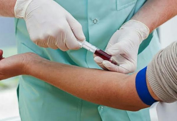 Common Misconceptions About Blood Tests at Home