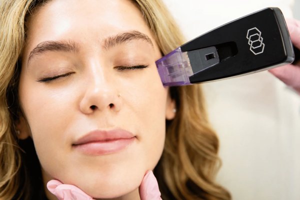 Is Morpheus8 in Dubai Effective for Renewing Body Skin Smoothness?