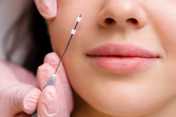 How Does Silhouette Soft Lift Differ From a Traditional Facelift?