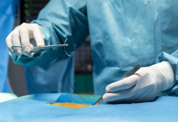 What Types of Procedures Can Be Done With Laparoscopic Surgery?
