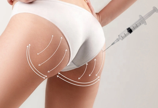 Can You Exercise After Hyacorp Fillers?