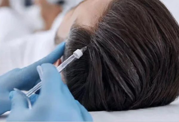 Is Prp Hair Treatment Safe?