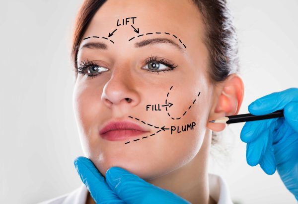 How Does Vector Facelift Differ From Mini Facelift?