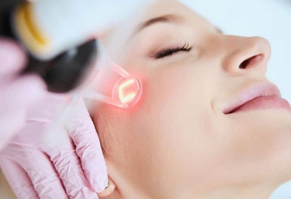 Can Fractional Laser with PRP Help Boost Skin Radiance?
