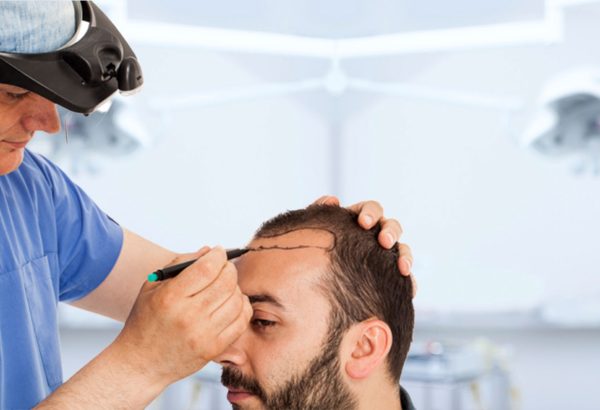 زراعة الشعر في دبي: رعاية ملكية وخصوصية تامة لكل مريض
