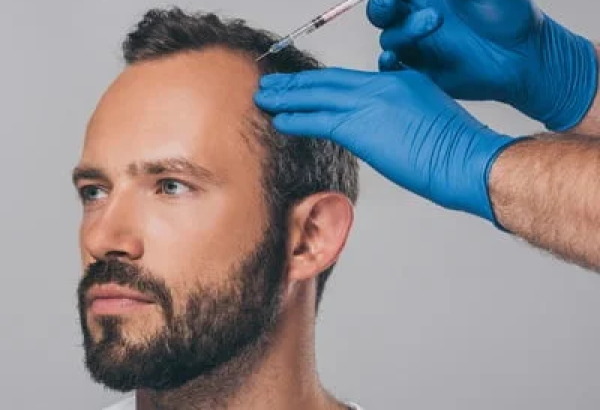 Is PRP Hair Treatment Effective for Hair Regrowth?