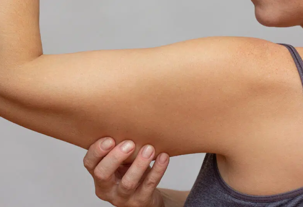 Is Arm Lift Surgery Considered Safe?