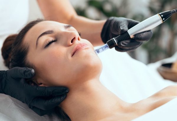 Who Is a Suitable Candidate for Dermapen Treatment?