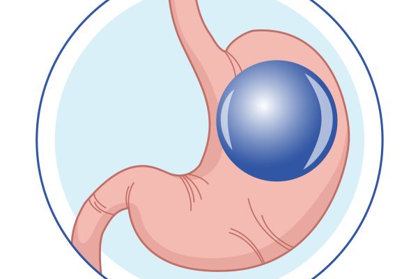 Does Allurion Gastric Balloon Clinic support healthier lifestyle shift?