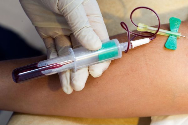 Blood Test at Home: What Your Results Can Tell You
