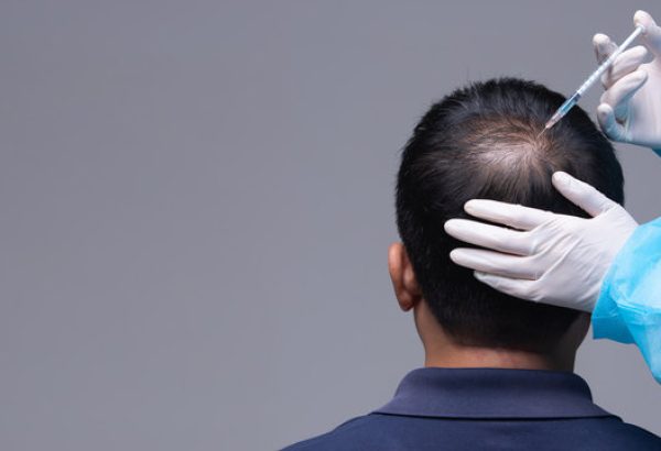 Can GFC Treatment For Hair Help Combat Seasonal Hair Loss?