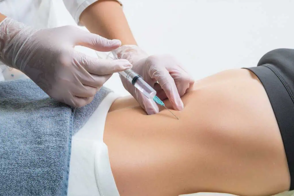 Can Fat Melting Injections help refine body curves beautifully?