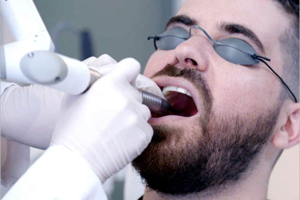 Who Is a Good Candidate for Laser Snoring Treatment?