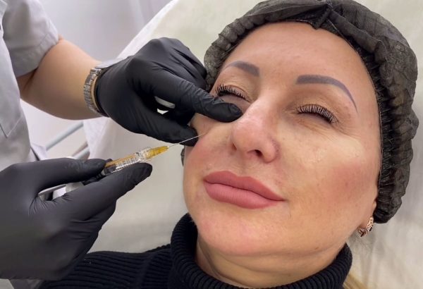 Is Botox a Smart Choice for Early Aging Prevention?