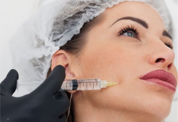 Is Sculptra Filler Effective For Improving Facial Fullness?