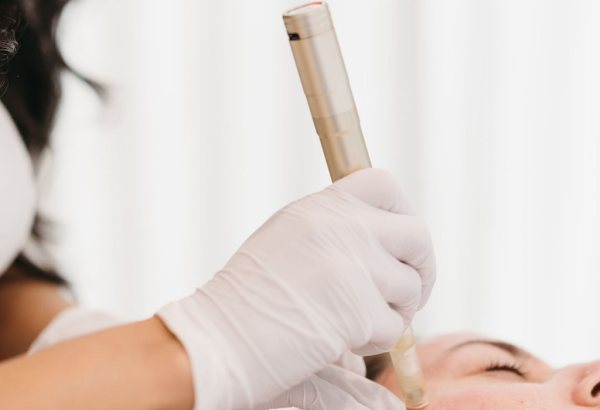 Who Is a Suitable Candidate for Microneedling?