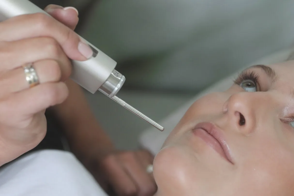 What Are the Benefits of Fotona 4D Facelift?