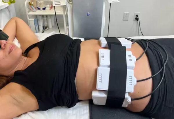 How Effective is Laser Liposuction for Belly Fat?