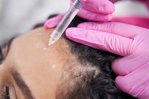Can G Cell Therapy Support Visible New Hair Formation?