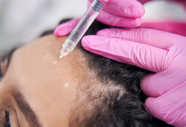 Can G Cell Therapy Support Visible New Hair Formation?