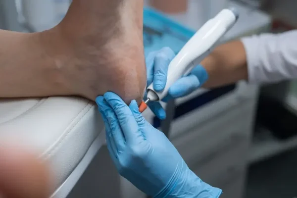 Foot Doctor in Columbia – Expert Care for Healthy Feet & Pain Relief