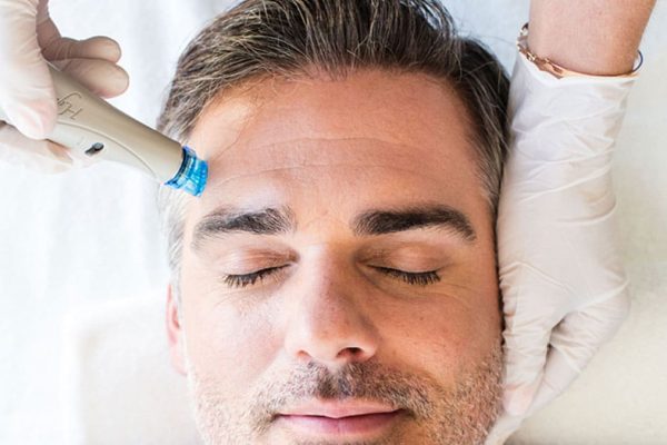 How Does HydraFacial for Men Improve Skin Health Better?