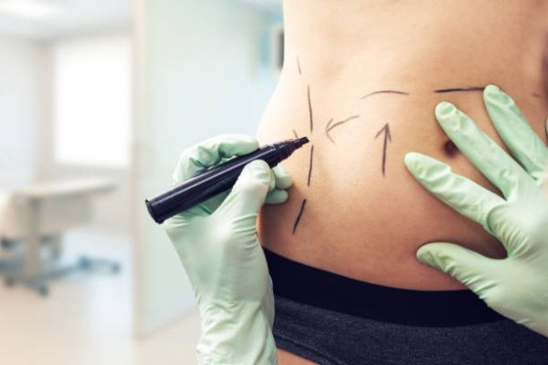How Liposuction in Dubai: Refining Jawlines & Necks?