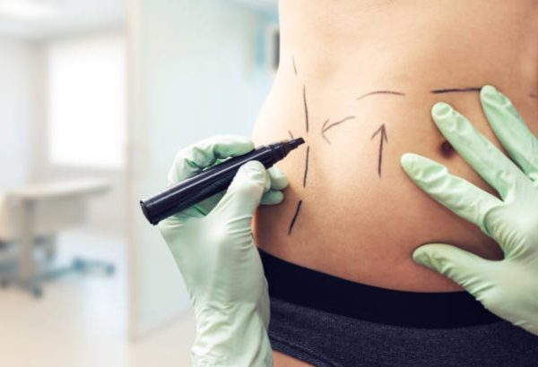 How Liposuction in Dubai: Refining Jawlines & Necks?