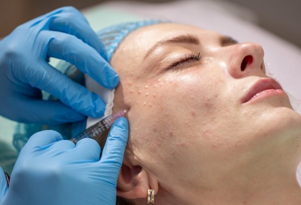 What Results Can You Expect From Dermal Fillers?