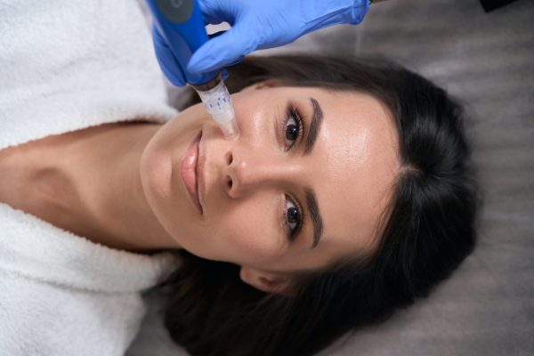 What Results Can You Expect From Microneedling Treatment?