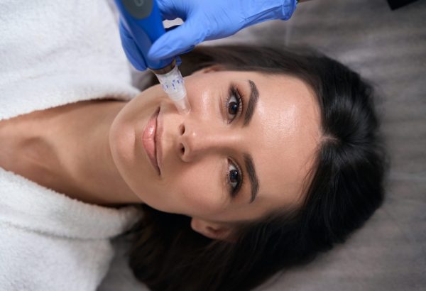 What Results Can You Expect From Microneedling Treatment?