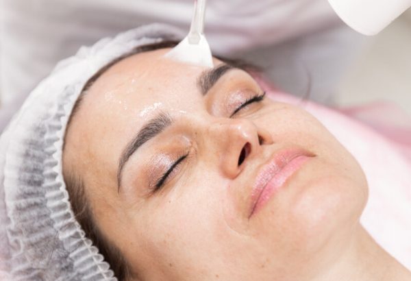Why Is Glycolic Acid Peel Treatment Chosen for Radiant Skin?