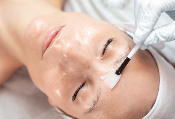 How Can chemical peel Support Healthy Skin Cell Renewal?