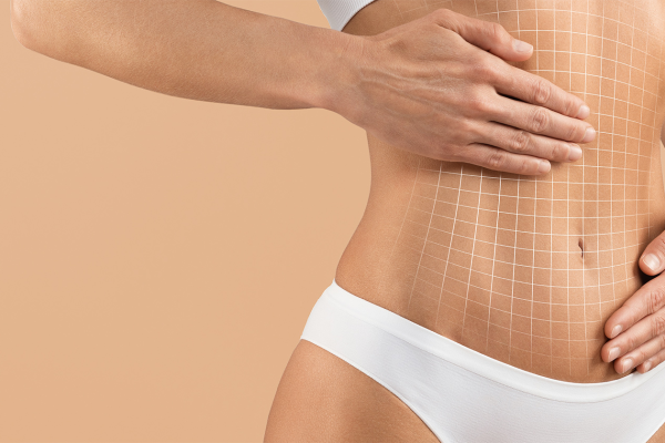 Why Choose Mini Abdominoplasty Today?