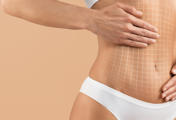 Why Choose Mini Abdominoplasty Today?