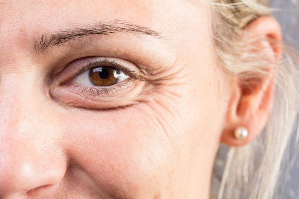 Blepharoplasty for Cosmetic Enhancement and Functionality
