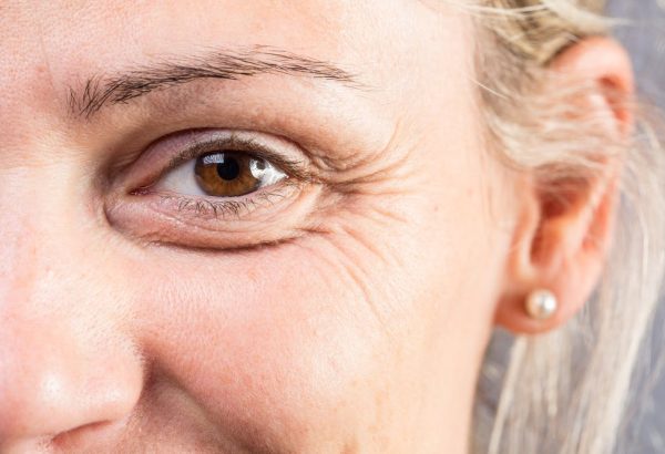 Blepharoplasty for Cosmetic Enhancement and Functionality