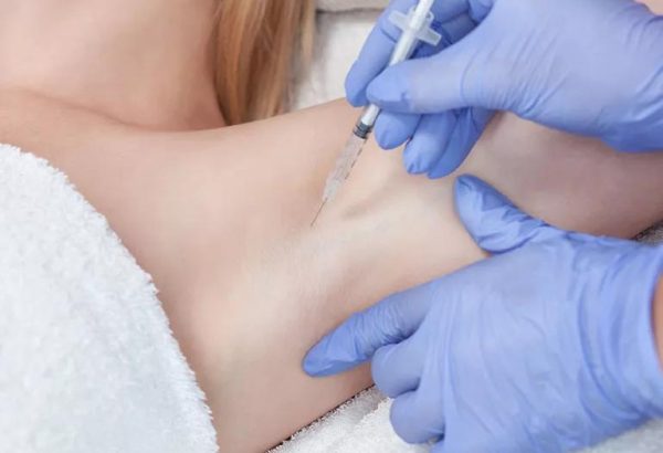 Who is the Best Candidate for Botox Sweat Gland Treatment?