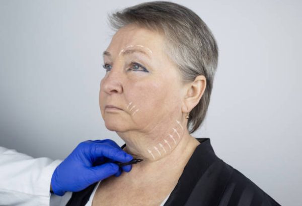 Endolift in Dubai for Sagging Skin and Facial Contours