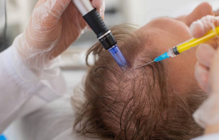 Exosome Hair in Dubai: Enhance Scalp and Hair Health