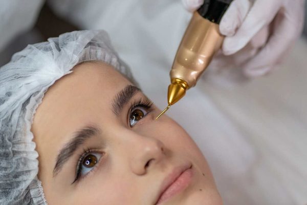 How Does Plasma Pen Treatment Tighten Loose Eyelid Skin?
