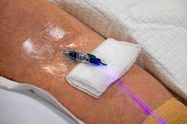 IV Laser Therapy in Dubai for Enhanced Cellular Vitality