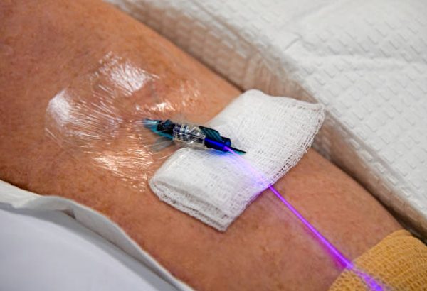 IV Laser Therapy in Dubai for Enhanced Cellular Vitality