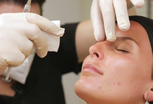 Is Nose Filler Treatment Painful During The Procedure?