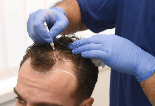Stem Cell Therapy Unlocks Deep Regeneration For Natural Healing Flow