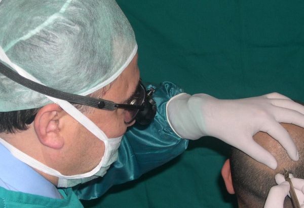 What Is the Success Rate of FUSS Hair Transplant Treatment?