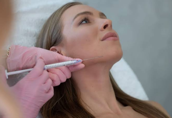 Why Choose Radiesse Filler for Facial Volume?