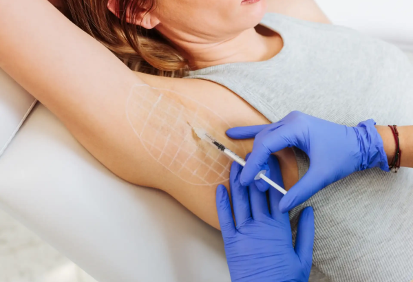 Who is the Best Candidate for Botox Sweat Gland Treatment?
